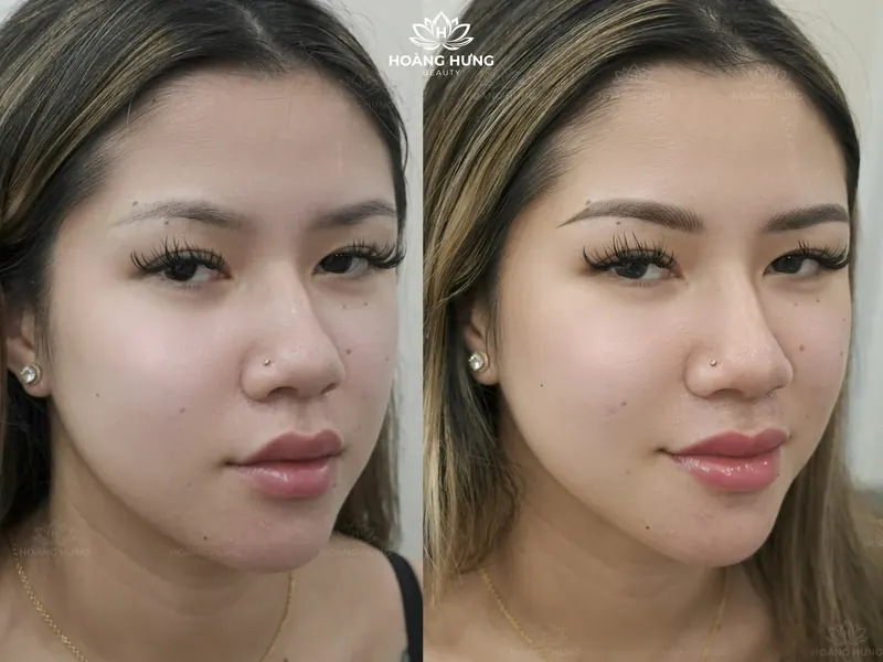 Trước và sau phun mày hiệu ứng — khách 1