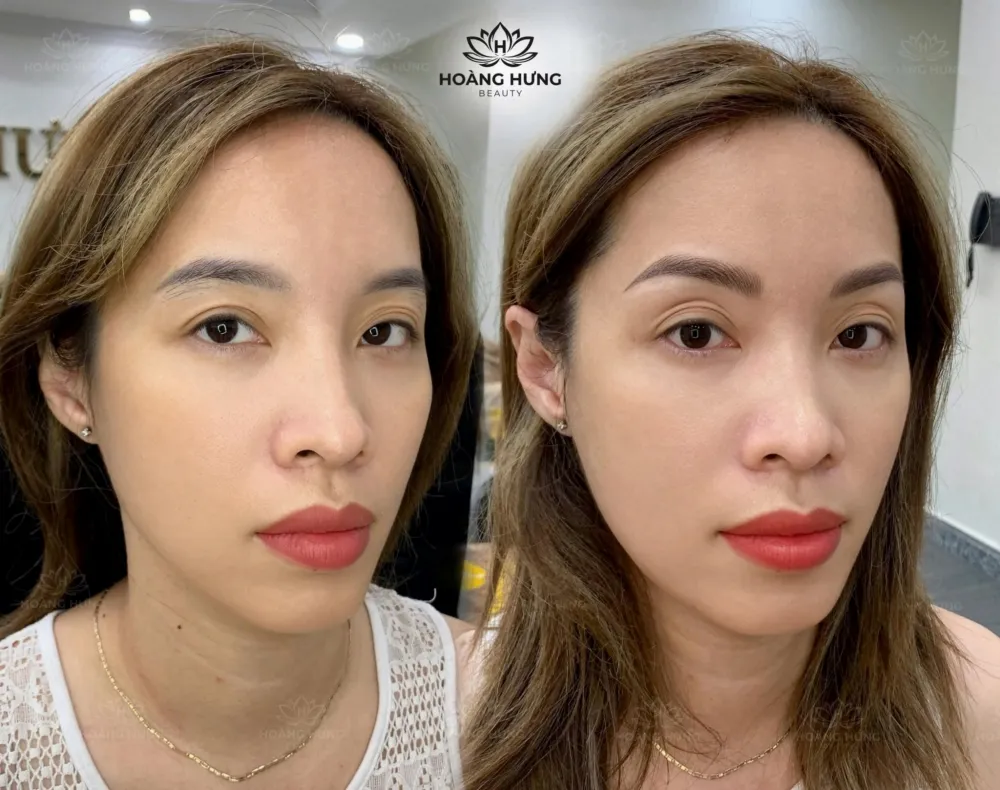 Khách hàng trước và sau khi làm chân mày tại Hoàng Hưng Beauty