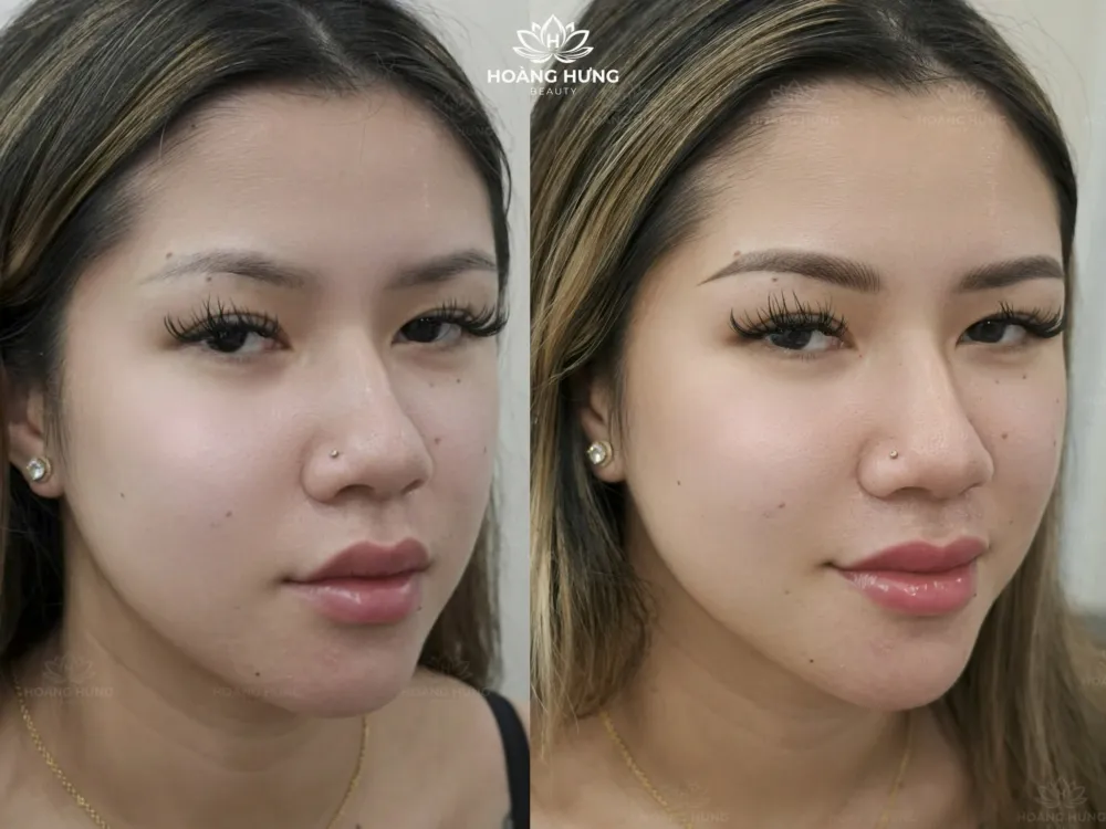 Khách hàng trước và sau khi làm chân mày tại Hoàng Hưng Beauty