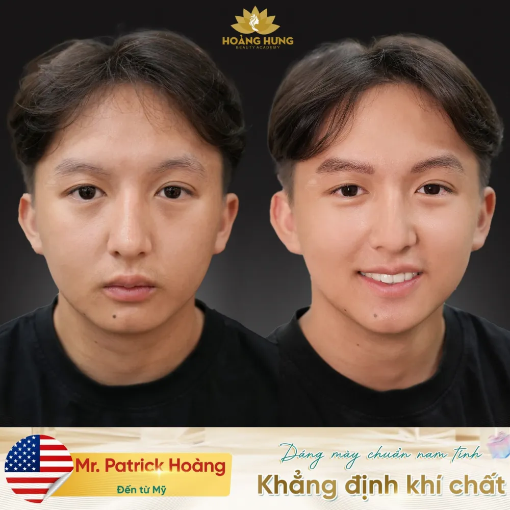 Khách nam trước và sau khi làm chân mày tại Hoàng Hưng Beauty