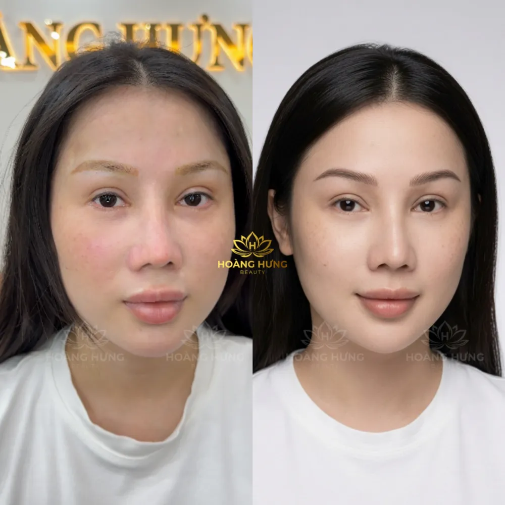 Khách hàng trước và sau khi làm chân mày tại Hoàng Hưng Beauty