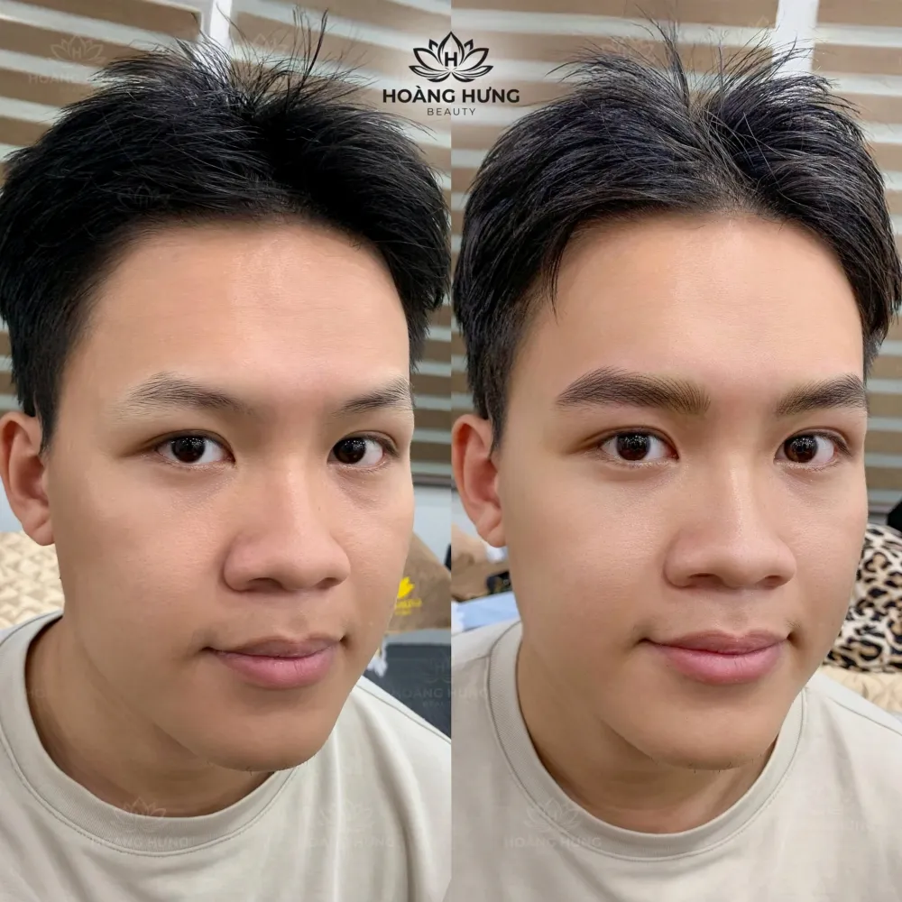 Khách nam trước và sau khi làm chân mày tại Hoàng Hưng Beauty